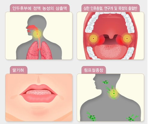 성홍열 증상 이미지./사진=질병관리청