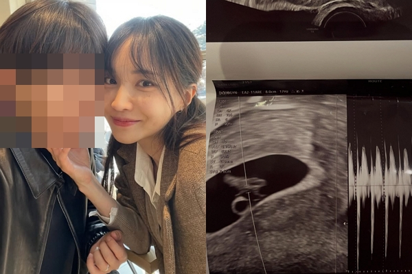 서은우 측은 남자친구 정씨를 향해 진정성 있는 대화를 원한다고 촉구했다. 사진은 서은우 남자친구와 서은우의 모습(왼쪽)과 서은우가 공개한 초음파 사진(오른쪽). /사진=서은우 인스타그램 캡처