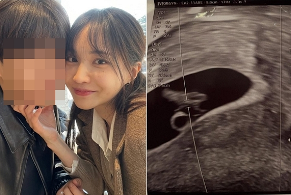 서은우가 임신 폭로, 스토킹 고소 이후 심경을 직접 밝혔다. 사진은 서은우와 서은우가 아이 아빠라고 주장한 남자친구의 모습(왼쪽)과 서은우가 공개한 초음파 사진(오른쪽). /사진=서은우 인스타그램 캡처