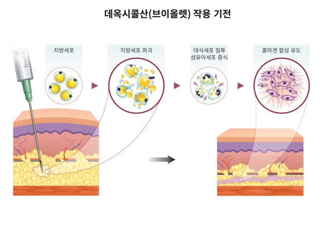 대웅제약이 데옥시콜산(DCA)의 팔뚝 지방분해 효과를 입증한 연구 결과를 SCIE급 저널에 발표했다. /사진=대웅제약 