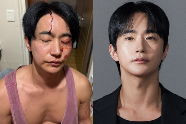 이미지
