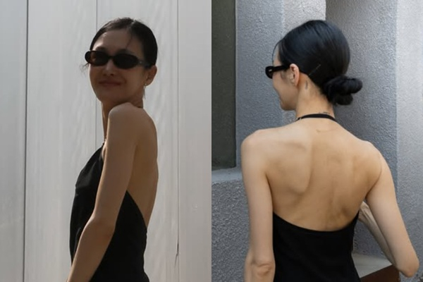 배우 엄태웅 아내이자 전직 발레리나 윤혜진이 완벽한 등근육으로 화제를 모았다. /사진=윤혜진 인스타그램