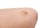 혈소판 감소증의 원인과 증상이 주목된다. 사진은 기사 내용과 무관함. /사진=클립아트코리아 