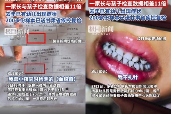 중국 서북부 간쑤성 한 유치원에서 아이들이 단체 납중독에 걸려 논란이 일고 있다. 사진은 중국 매체 지무신문에서 보도한 납중독 사건의 모습. /사진=지무신문 영상 캡처