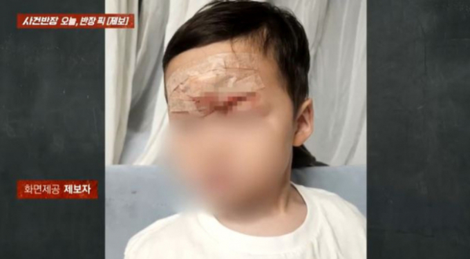 키즈카페에서 놀던 3세 아이가 놀이기구에 노출된 철심에 이마가 찢어지는 사고를 당했지만 카페 측은 사과는 커녕 계속 놀이기구를 운영했다는 주장이 나왔다. /사진=JTBC '사건반장' 방송캡처