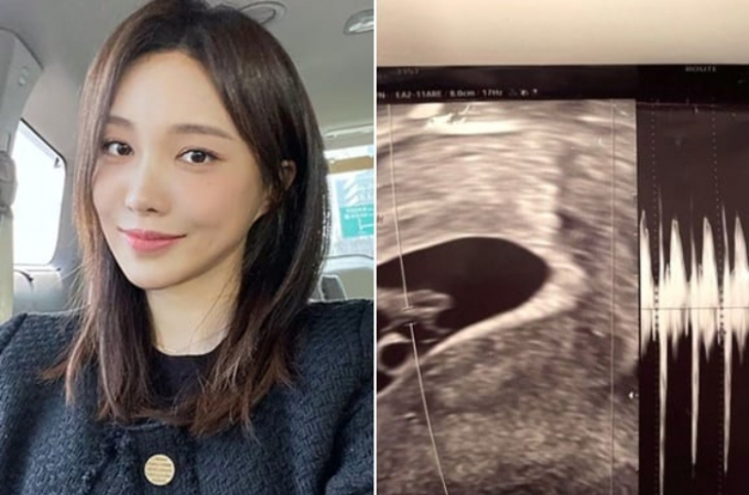 채널A '하트시그널3' 출신 서민재(개명 후 서은우)가 친부 A씨 측 입장에 의미심장한 글을 남기면서 우려를 낳고 있다. /사진=서민재 인스타그램