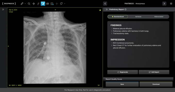 딥노이드가 생성형 AI 의료기기 'M4CXR' 임상에 나섰다. 사진은 M4CXR 판독 예시. /사진=딥노이드