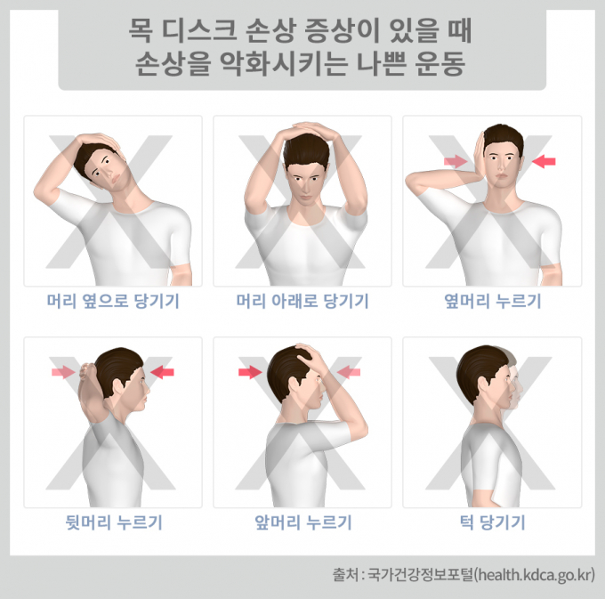 사진은 목디스크 손상을 악화하는 스트레칭. /사진=질병관리청 국가건강정보포털