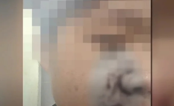 폭행당하는 중학생을 돕던 20대 남성이 전치 2주 부상을 입고 아동학대 혐의로 고소까지 당했다. 사진은 집단 폭행당하는 남학생을 돕던 20대 남성이 전치 2주 부상을 입은 모습. /사진=JTBC '사건반장' 캡처