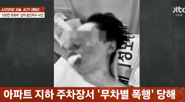 인천 송도서 납치돼 무차별 폭행을 당한 100만 유튜버 수탉의 피해 수준이 심각한 것으로 드러났다. 사진은 폭행당한 유튜버 '수탉'의 모습. /사진=JTBC '사건반장' 캡처